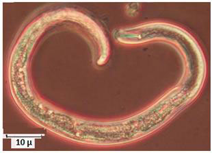 Spiral nematode (Helicotylenchus sp.) adult showing the characteristic spiral body shape with a stout tail and a short, stout stylus.