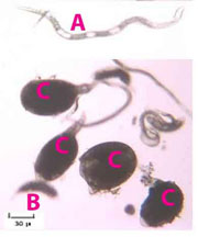 Meloidogyne larvae (A), young female (B), and mature female (C) showing body shape.