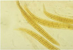 Ascospores of Ophiosphaerella korrae.
