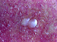 Figure 6. Eggs of the codling moth are laid on leaves or fruit. Photograph courtesy of Ken Gray Collection/Oregon State University.