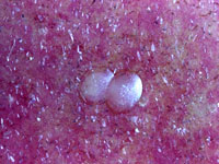 Eggs of the codling moth are laid on leaves or fruit.