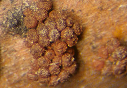 Sexual perithecia of Coral spot nectria.