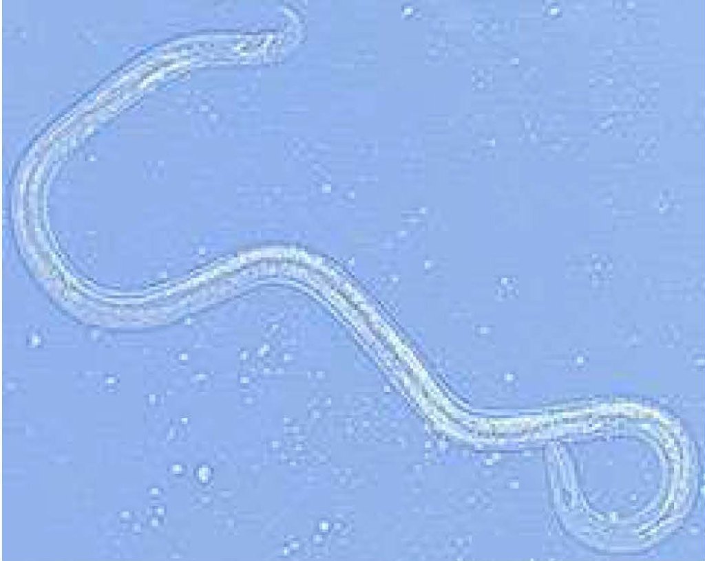 A pine wilt nematode, viewed through a light microscope. 