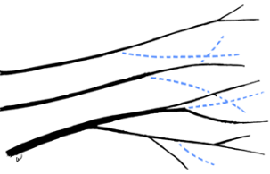 Diagram of removal cuts that eliminate a side branch back to the trunk or parent branch.