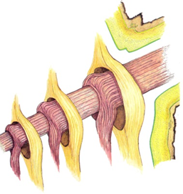 Drawing of branch with different layers of tissue in different colors, showing where growth rings of the trunk overlap with growth rings of branches. Three branches, with overlapping tissue 